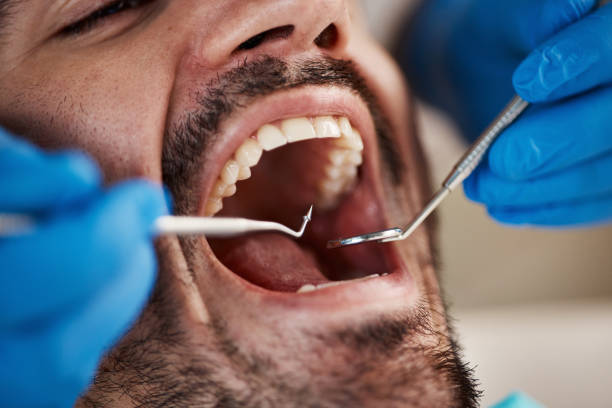 Oral Surgery in West Columbia, TX